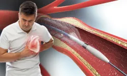 Stent korkusu hayatınıza mal olabilir!